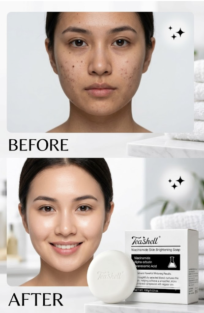 Teashell Niacinamide Whitening Soap – Bright, Smooth & Glowing Skin